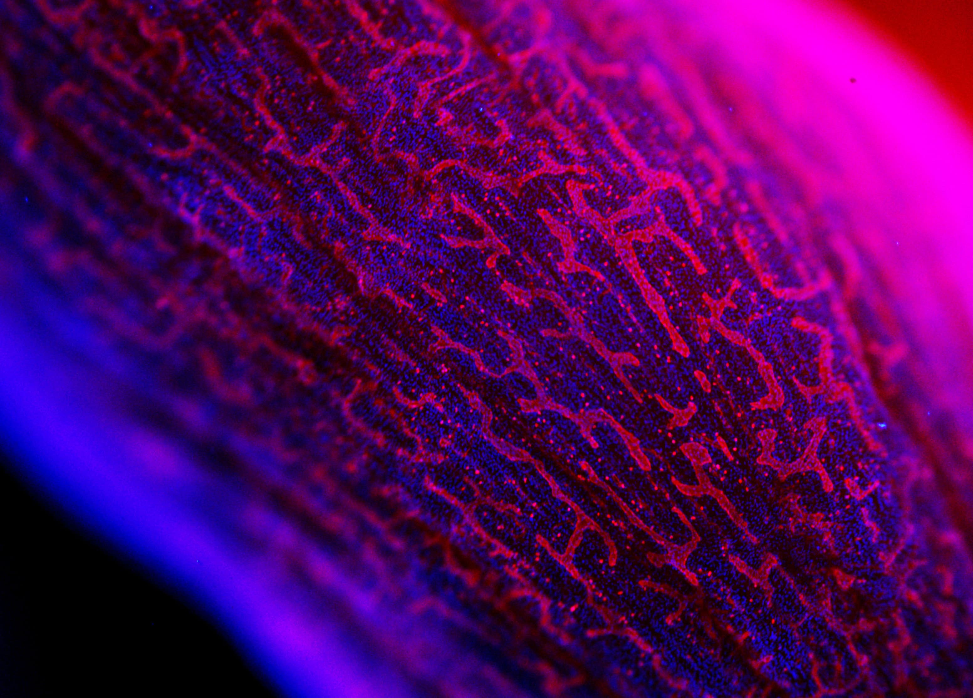 "Lymphatic vessels on the surface of mouse uterine horns". Edition: FOTCIENCIA18. Author: Christian Lachaud. The image shows the uterine horns of a mouse under the microscope. The lymphatic vessels are shown in red.