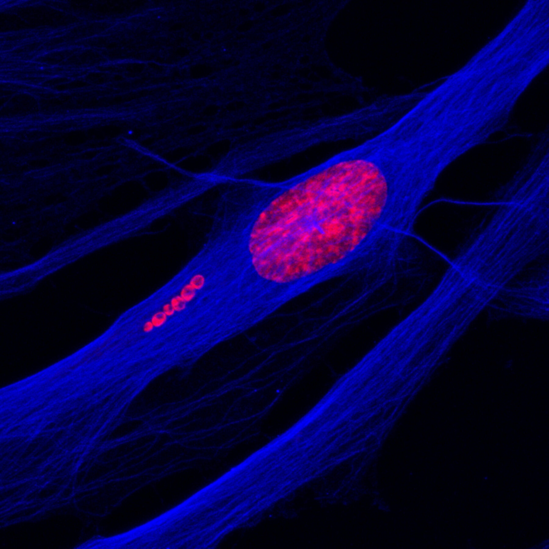 The photo shows a human stem cell during the early stages of becoming a neuron. The DNA is coloured in red, and the cell skeleton in blue. In the image you can see show six spherical particles, containing DNA and therefore in red, moving away from the cell nucleus.
