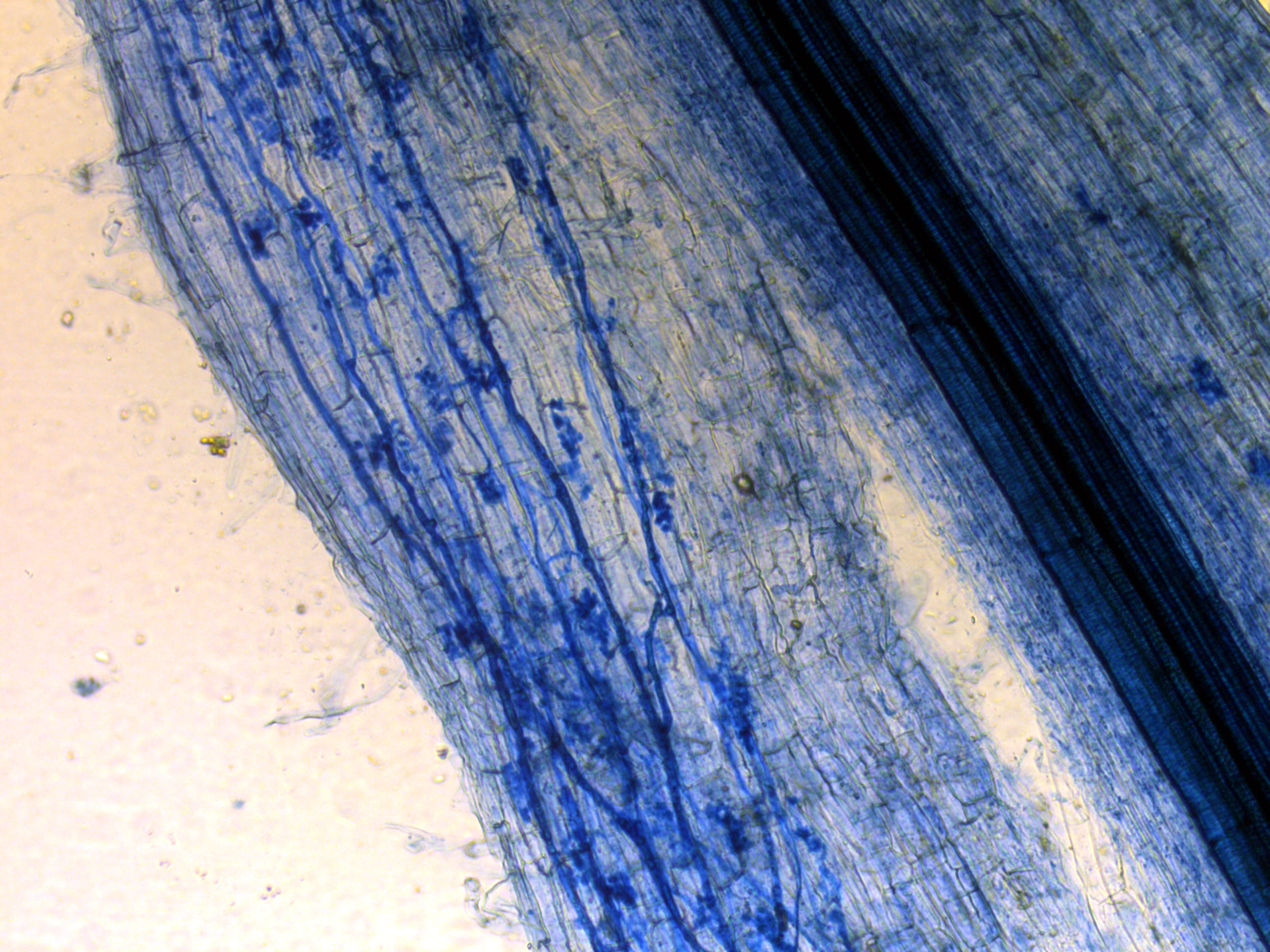 En la foto se ve, aumentada por 100, una raíz de lechuga teñida con azul tripán. En diagonal azul oscuro destaca el vaso que se encarga de llevar agua a todas las partes de la planta. Más abajo, en azul más intenso se distinguen estructuras características de un hongo micorrízico. 