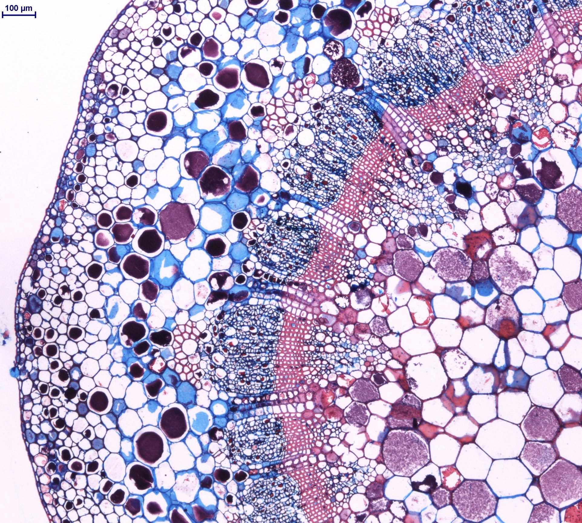 En la imagen se observa la zona de unión entre la planta y el racimo de uvas. En esta zona, llamado pedúnculo, los elementos celulares se disponen formando patrones sin dejar espacio entre ellos. En azul, se visualizan los depósitos de celulosa, y en rosa, los depósitos de lignina en las paredes vegetales de las células. 