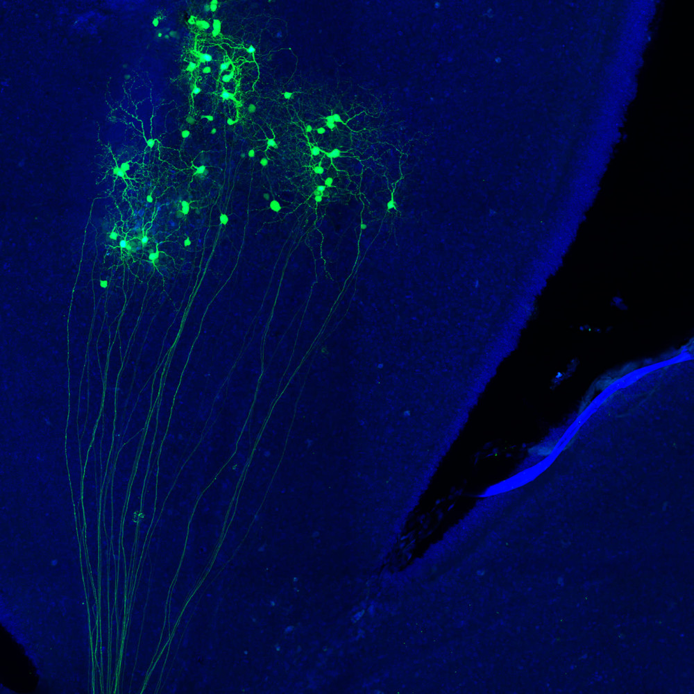 The image shows a set of GFP-labelled retinal ganglion cells (in green) and their respective axons, which will continue their journey through the optic nerve to the main visual centres of the brain.