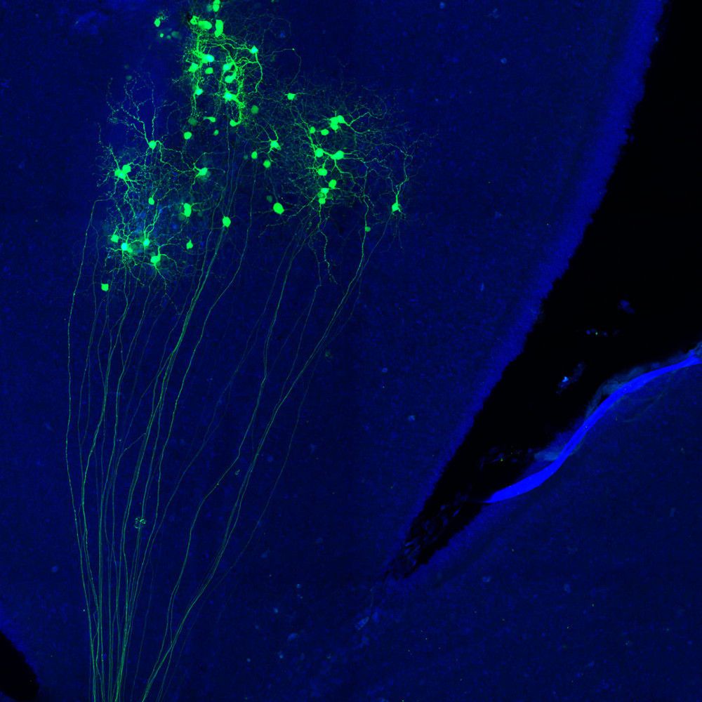"Constelation". Edition: FOTCIENCIA19. Author: Verónica Murcia-Belmonte. The image shows a set of GFP-labelled retinal ganglion cells (in green) and their respective axons, which will continue their journey through the optic nerve to the main visual centres of the brain.