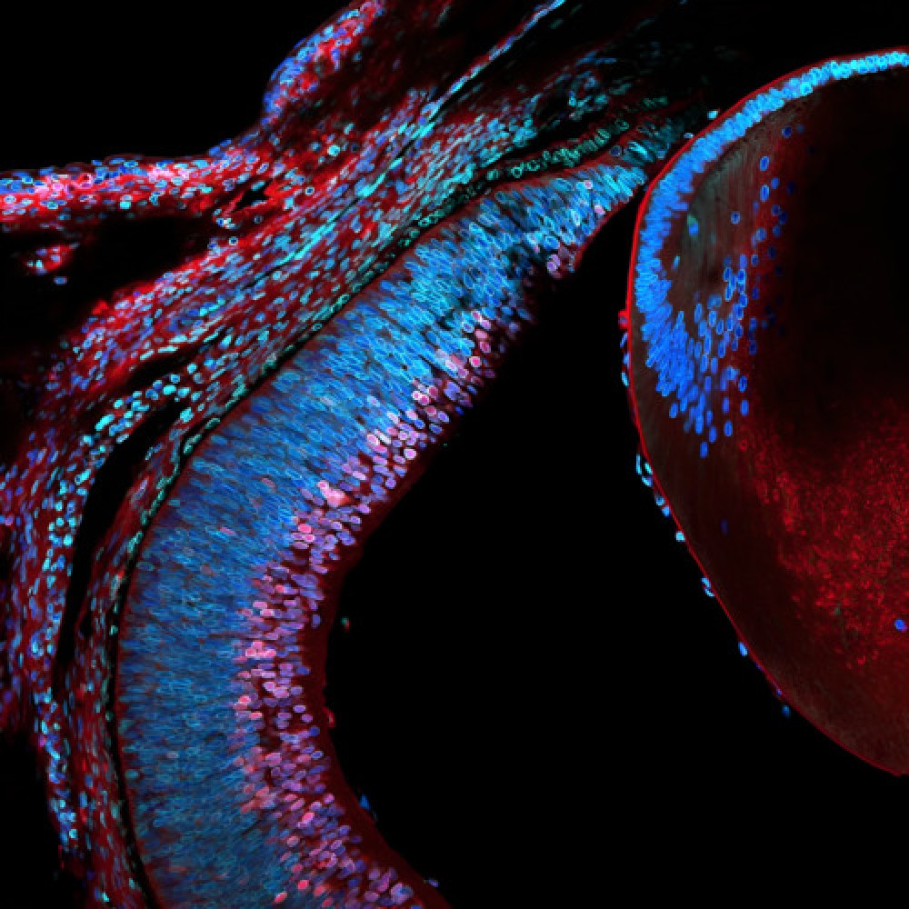 The image shows the eye of a mouse in the embryonic age with its lens and retina.