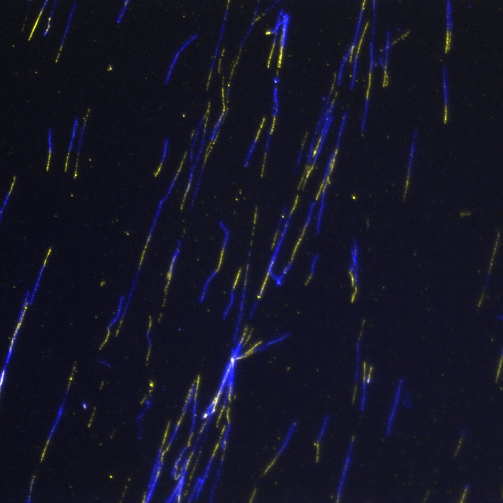 "Fibres rain". Edition: FOTCIENCIA19. Author: Aina Mª Mas Calafell. The image shows stretched and marked DNA fibres through a fluorescence microscope. This technique is used to study the replicative pattern of cells. When a cell is replicating its DNA, that piece is incorporated into the nascent strand; then we can detect it by immunofluorescence, as shown in yellow on the photo. In blue, we can also see a general DNA stain with the use of a fluorescent antibody that recognises single-stranded DNA.