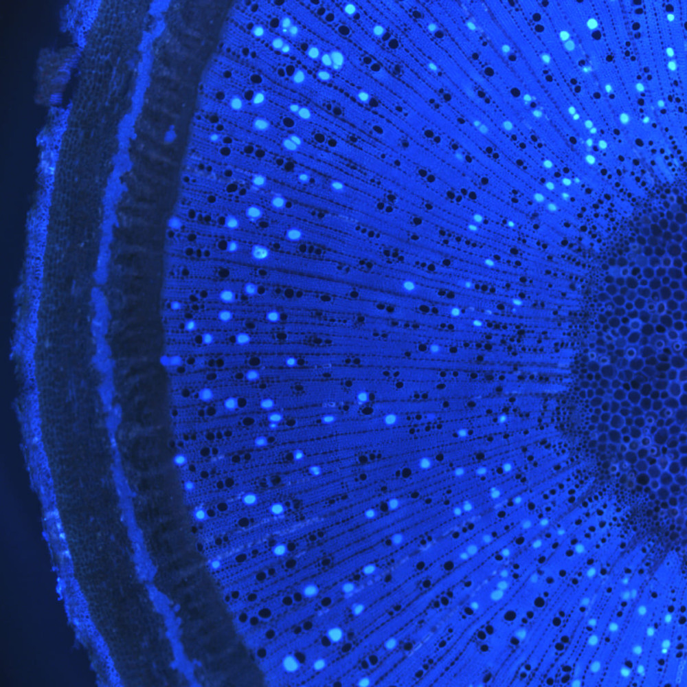 "Vascular stars". Edition: FOTCIENCIA8. Author: José Manuel Torres Ruiz. The photograph shows, in intense blue and fluorescent, the vessels that are responsible for transporting water in plants and which, in the following branching, are diverted towards the leaves. The rest of the vessels that can be seen, also in blue but with no fluorescence, continue their upward path to provide the water and nutritional to the higher areas of the plant.