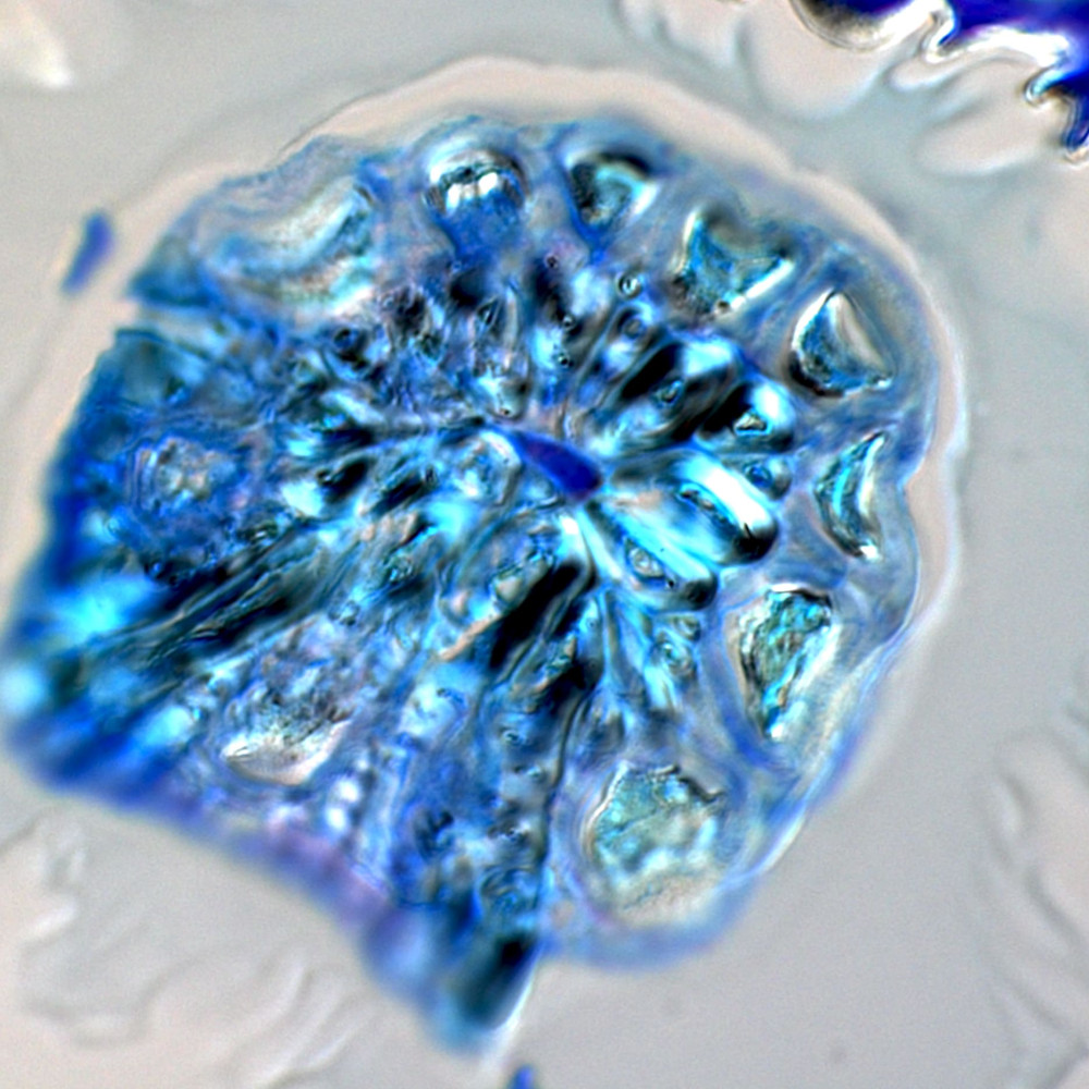 "Nacre in the leaves". Edition: FOTCIENCIA16. Author: Juan Losada. The image shows a paradermal section (parallel to the plane of a leaf) revealing the base of an idioblast. Idioblasts are cells whose wall thickens very strongly to support some leaves.
