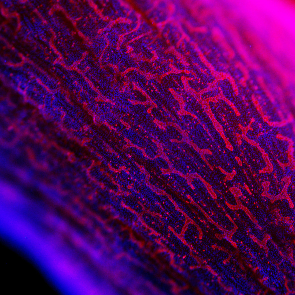 "Lymphatic vessels on the surface of mouse uterine horns". Edition: FOTCIENCIA18. Author: Christian Lachaud. The image shows the uterine horns of a mouse under the microscope. The lymphatic vessels are shown in red.