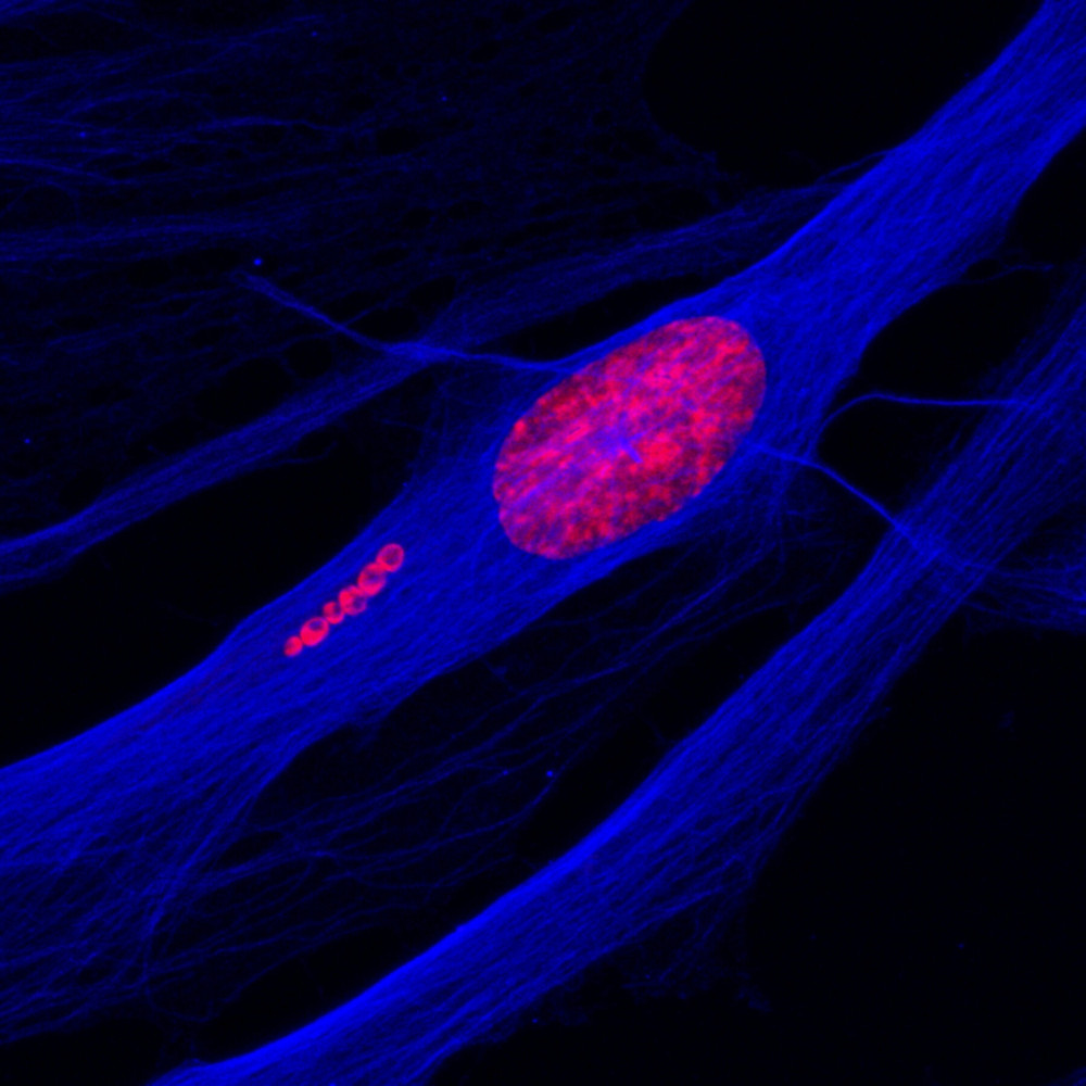 "Let´s get going". Edition: FOTCIENCIA18. Author: Carlos Bueno López. The photo shows a human stem cell during the early stages of becoming a neuron. The DNA is coloured in red, and the cell skeleton in blue. In the image you can see show six spherical particles, containing DNA and therefore in red, moving away from the cell nucleus.
