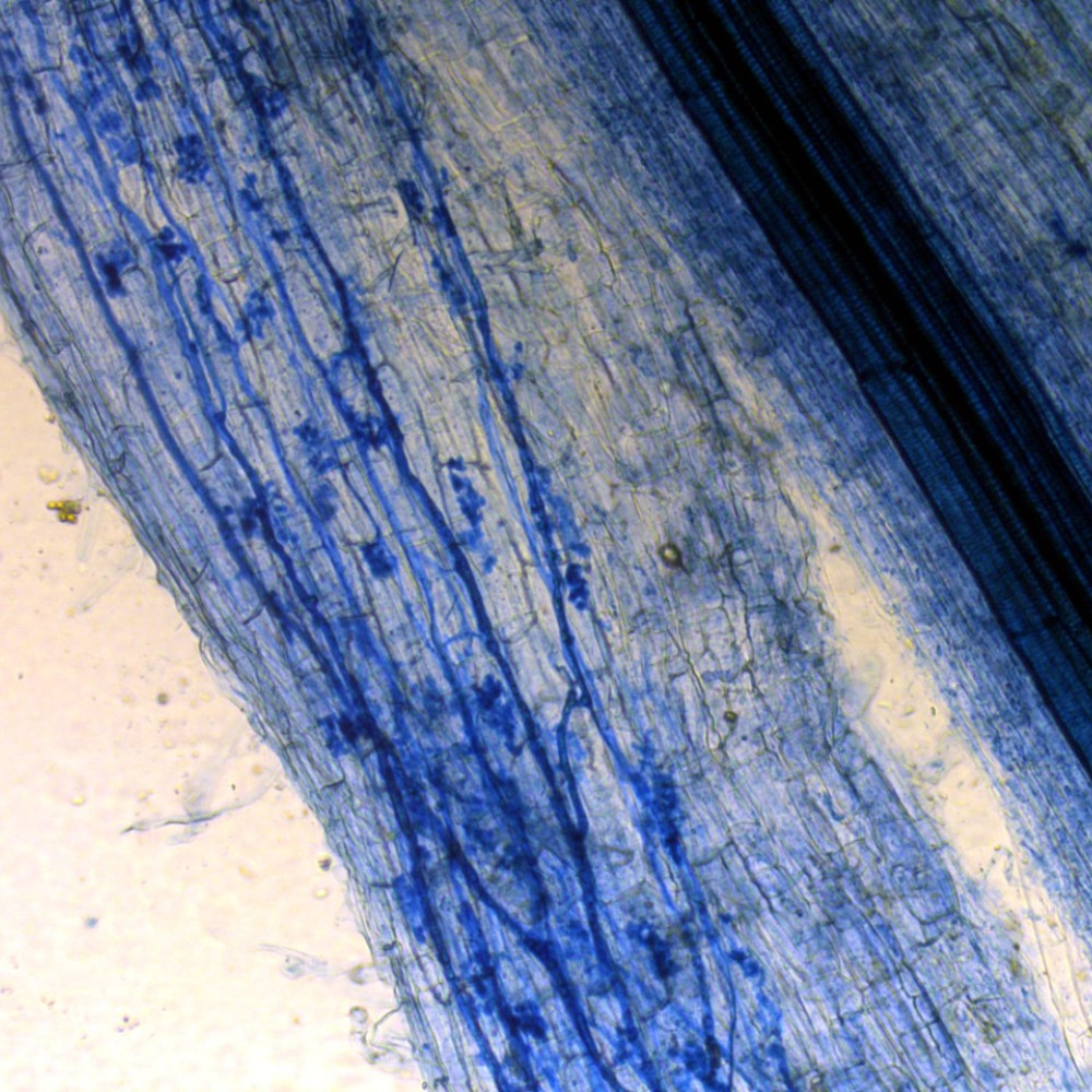 En la foto se ve, aumentada por 100, una raíz de lechuga teñida con azul tripán. En diagonal azul oscuro destaca el vaso que se encarga de llevar agua a todas las partes de la planta. Más abajo, en azul más intenso se distinguen estructuras características de un hongo micorrízico. 